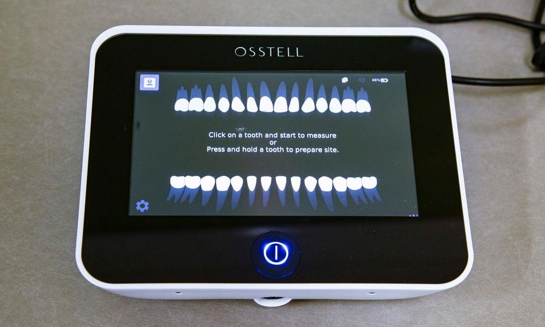 close up of osstell IDx machine l markham street dental